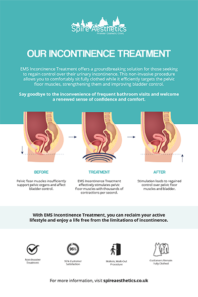 image of how urge incontinence Stockwood treatment works